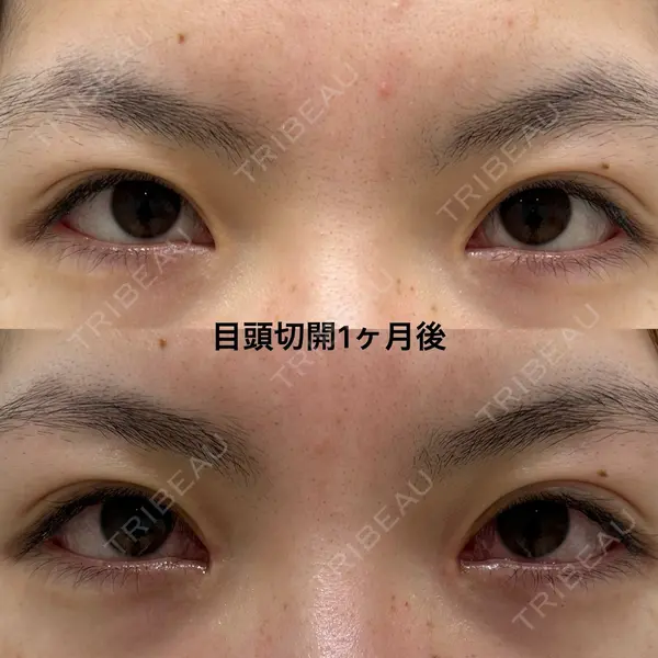 エターナル美容クリニック 久門田 詳医師の症例