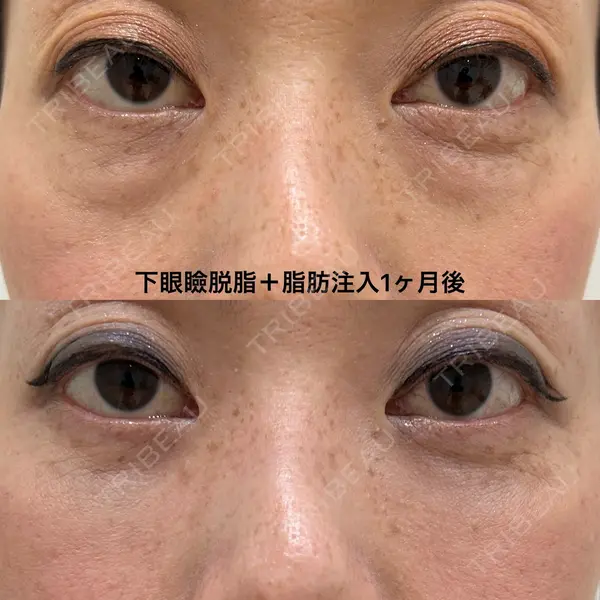 エターナル美容クリニック 久門田 詳医師の症例