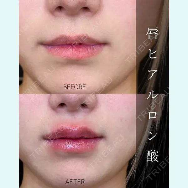 ルラ美容クリニック 大宮院 / ルラスキンクリニック 大宮院 右京 大季医師の症例