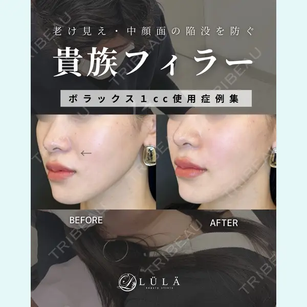 ルラ美容クリニック 大宮院 / ルラスキンクリニック 大宮院 右京 大季医師の症例