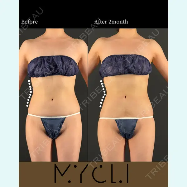 MYCLI【マイクリ】大阪・梅田院 三木 晶森医師の症例