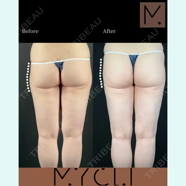 MYCLI【マイクリ】大阪・梅田院 三木 晶森医師の症例