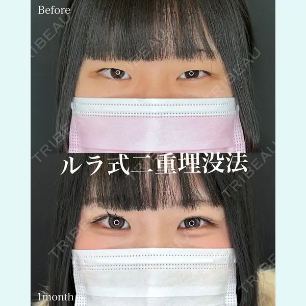 ルラ美容クリニック 名古屋本院 山本 美佳医師の症例