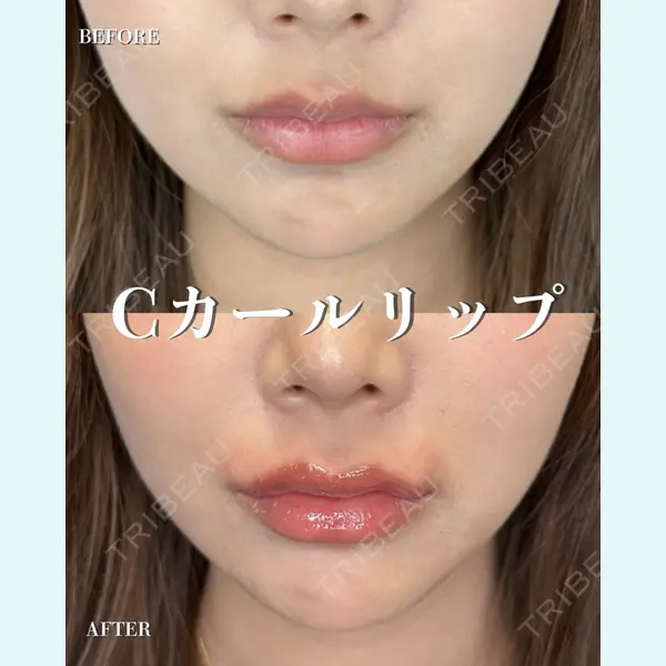 ルラ美容クリニック 千葉院 / ルラスキンクリニック 千葉院 下川 洋輝医師の症例