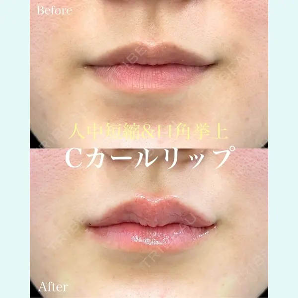 ルラ美容クリニック 名古屋本院 山本 美佳医師の症例