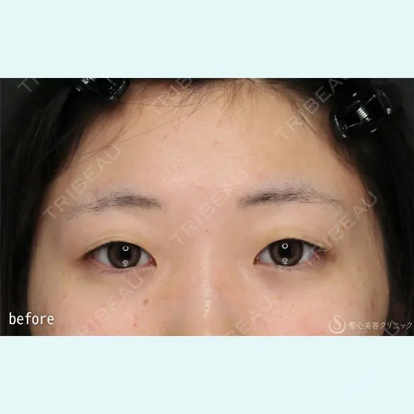 聖心美容クリニック 銀座院 石井 陸医師の症例