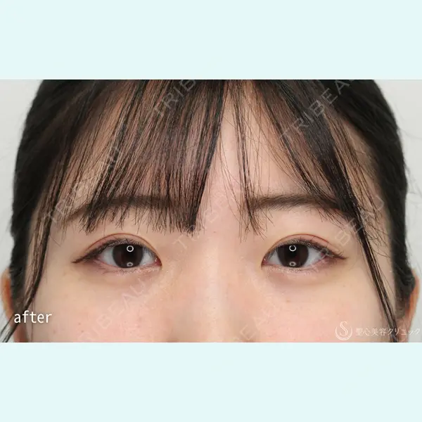 聖心美容クリニック 銀座院 石井 陸医師の症例