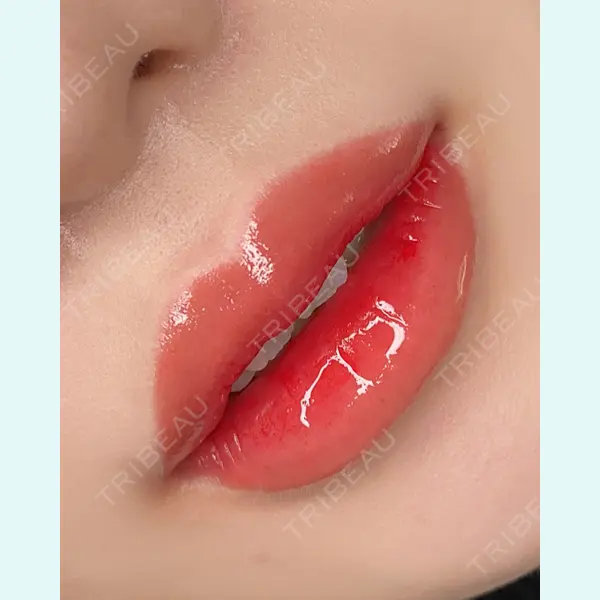 さっぽろ美容クリニックの症例