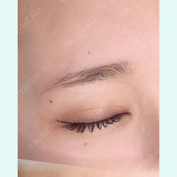 さっぽろ美容クリニックの症例