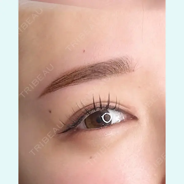 さっぽろ美容クリニックの症例