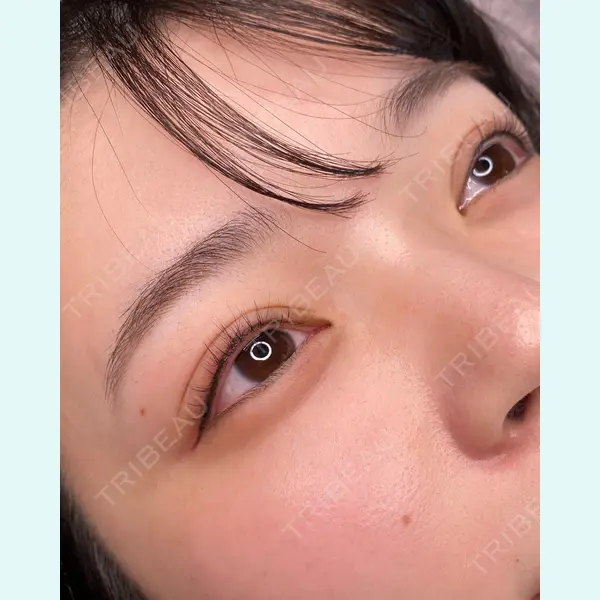 さっぽろ美容クリニックの症例