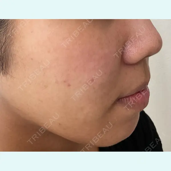 やさしい美容皮膚科・皮フ科　秋葉原院 宇井 千穂医師の症例