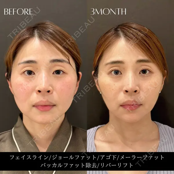 RIVER CLINIC（リバークリニック）の症例