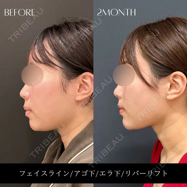 RIVER CLINIC（リバークリニック）の症例