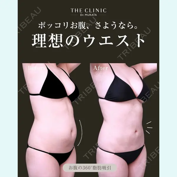 THE CLINIC（ザ・クリニック） 東京院 村田 八千穂医師の症例