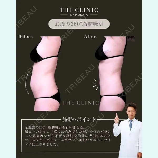 THE CLINIC（ザ・クリニック） 東京院 村田 八千穂医師の症例