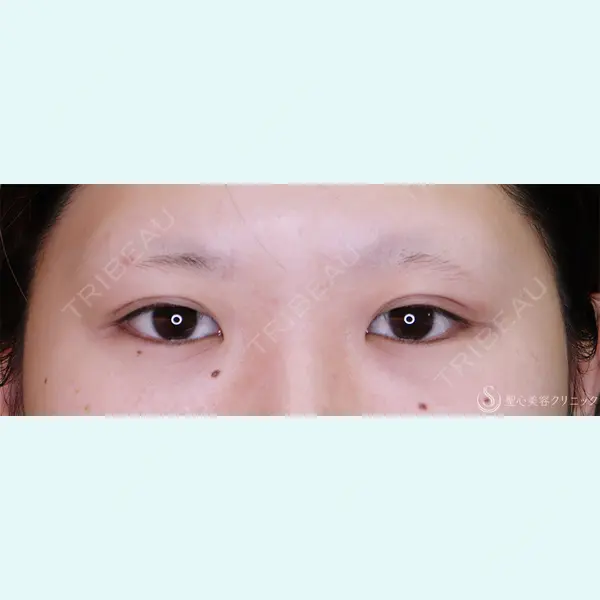 聖心美容クリニック 横浜院 佐々木 直美医師の症例