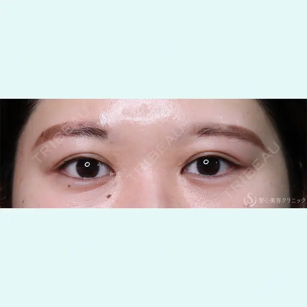 聖心美容クリニック 横浜院 佐々木 直美医師の症例