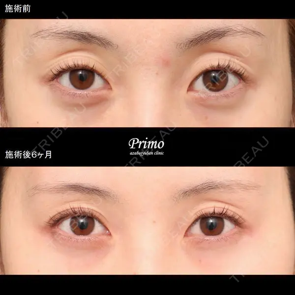 プリモ麻布十番クリニック 大場教弘医師の症例