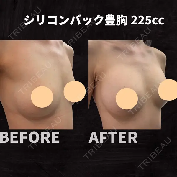 美容外科川崎クリニック 大阪梅田院 高牟禮 彰医師の症例