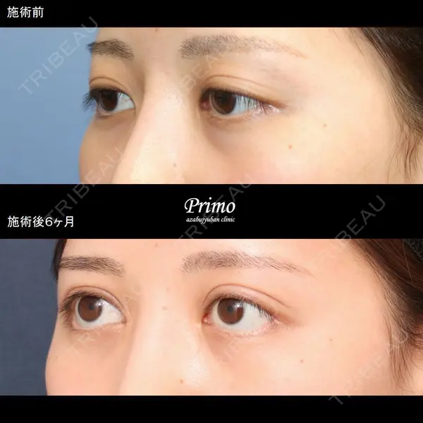プリモ麻布十番クリニック 大場教弘医師の症例