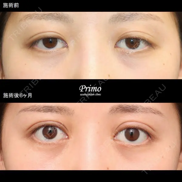 プリモ麻布十番クリニック 大場教弘医師の症例