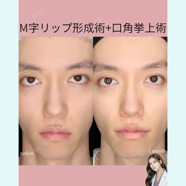 千葉美容外科アイビークリニックの症例