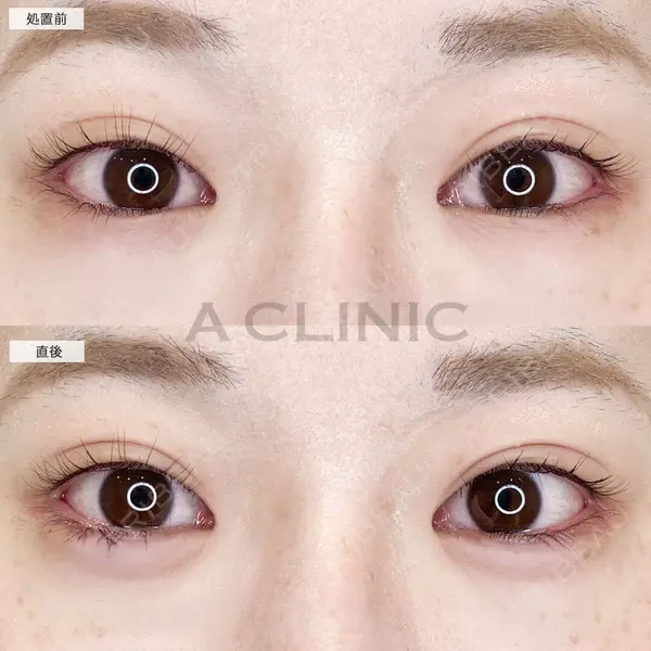 A CLINIC（エークリニック） 仙台院 伊藤 瑠桂医師の症例