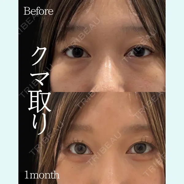 ネビュラクリニック 東京錦糸町院 岩切 琢磨医師の症例