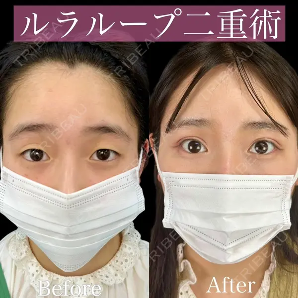 ルラ美容クリニック 渋谷本院 昼間 路子医師の症例