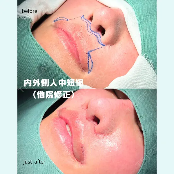 PRISM Beauty Clinic 町田院 森本 理一郎医師の症例