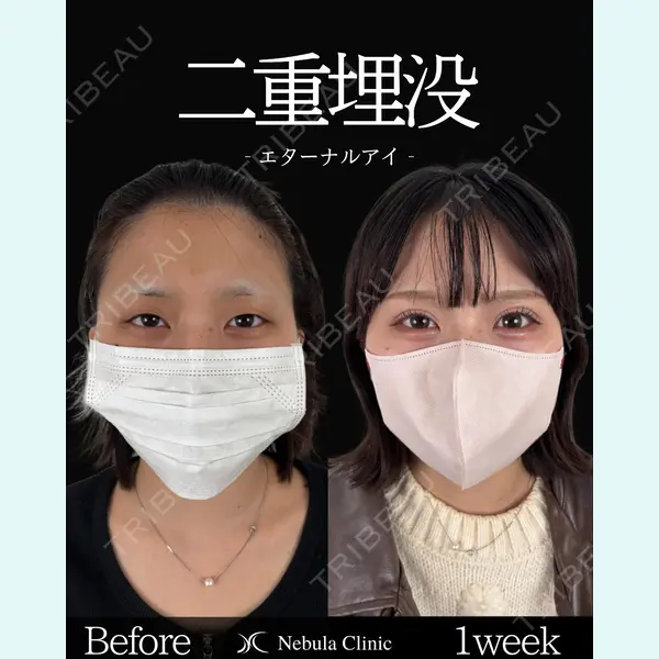 ネビュラクリニック 東京錦糸町院 岩切 琢磨医師の症例