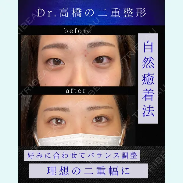 吉祥寺アイビークリニック 高橋 京佑 医師の症例