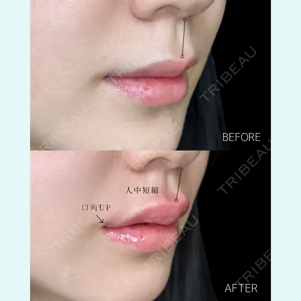 ルラ美容クリニック 大宮院 / ルラスキンクリニック 大宮院 右京 大季医師の症例