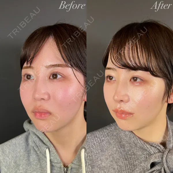 R Beauty CLINIC 大阪院 小池 泰弘医師の症例