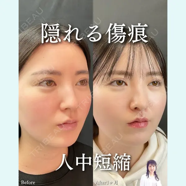 ルラ美容クリニック 渋谷本院 住友 沙織医師の症例