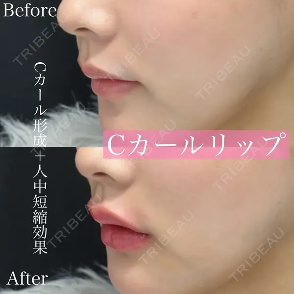 ルラ美容クリニック 渋谷本院 昼間 路子医師の症例