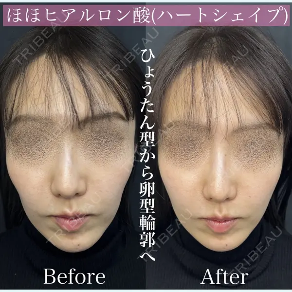 ルラ美容クリニック 渋谷本院 昼間 路子医師の症例