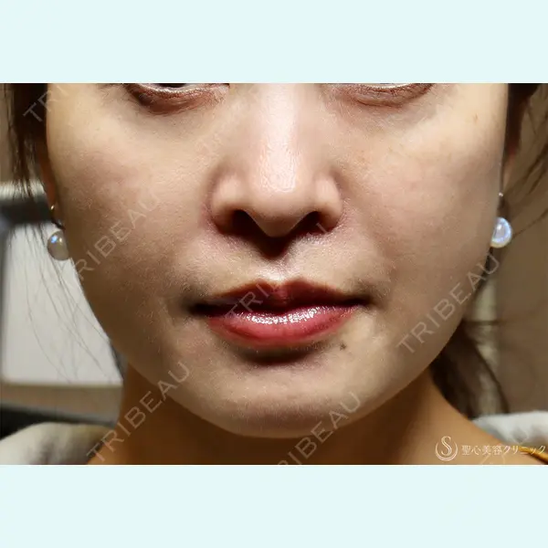 聖心美容クリニック 六本木院 伊藤 康平医師の症例