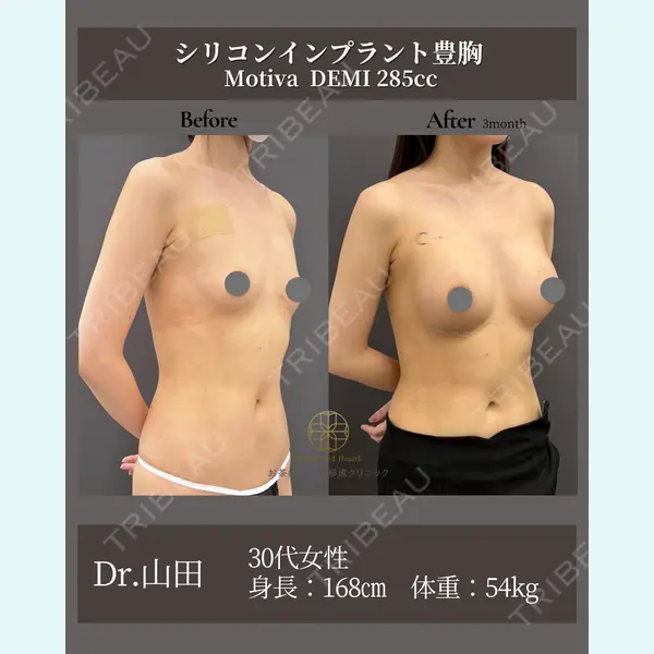 お茶の水美容形成クリニック 山田 淳生医師の症例