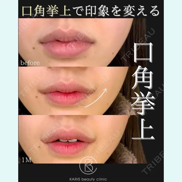 KARIS beauty clinic 滝内 ヒロフミ医師の症例
