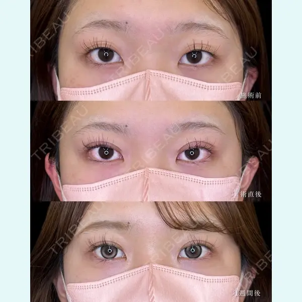 ルラ美容クリニック 大宮院 / ルラスキンクリニック 大宮院 右京 大季医師の症例