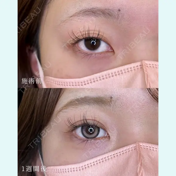 ルラ美容クリニック 大宮院 / ルラスキンクリニック 大宮院 右京 大季医師の症例