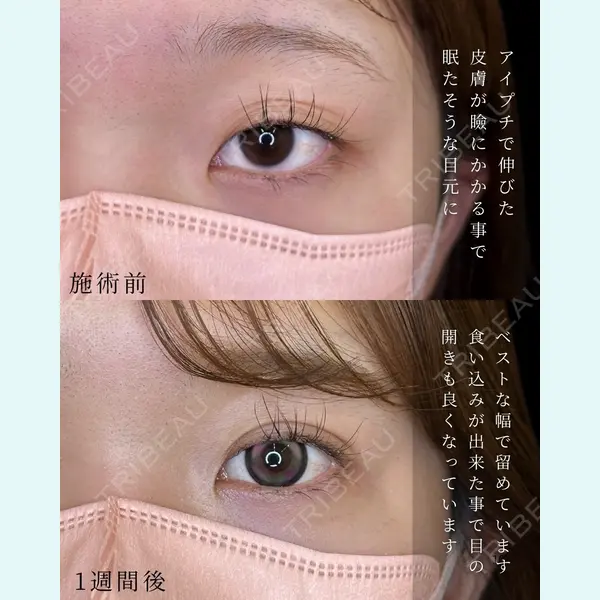 ルラ美容クリニック 大宮院 / ルラスキンクリニック 大宮院 右京 大季医師の症例