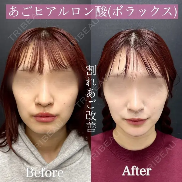 ルラ美容クリニック 渋谷本院 昼間 路子医師の症例