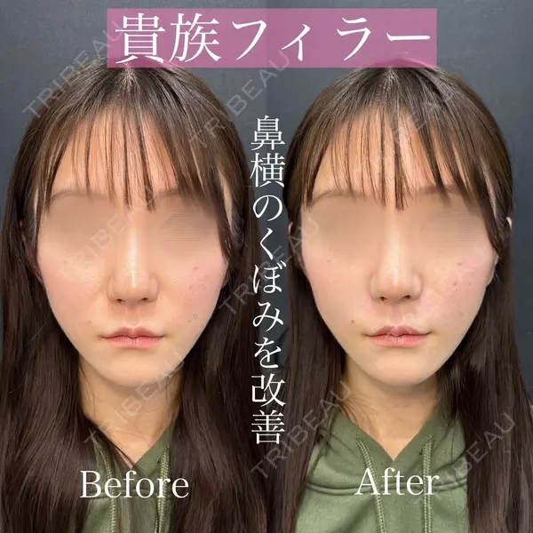 ルラ美容クリニック 渋谷本院 昼間 路子医師の症例