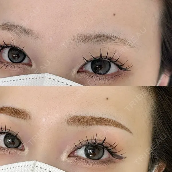 クレアージュ 福岡院の症例