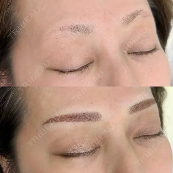 クレアージュ 福岡院の症例