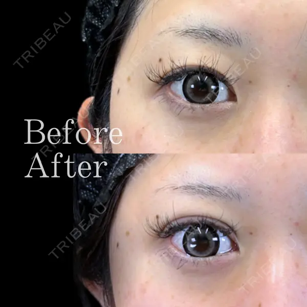 Leap beauty clinic 土門 駿也医師の症例