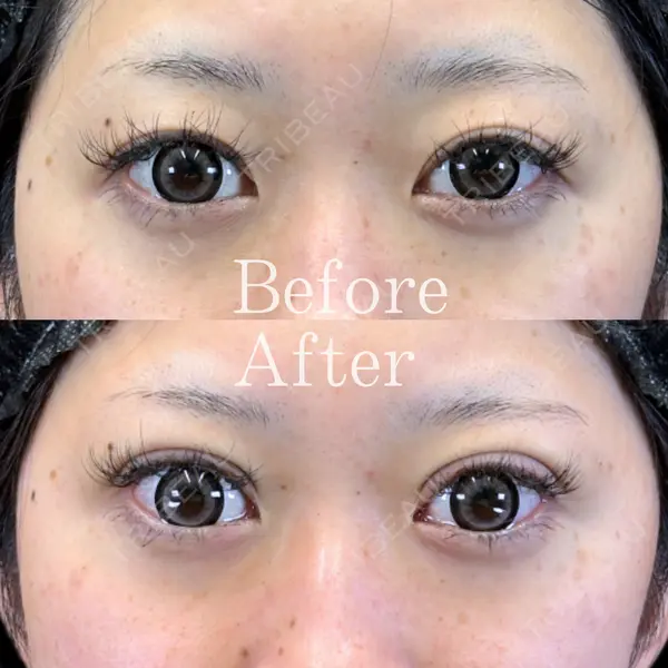 Leap beauty clinic 土門 駿也医師の症例